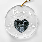 Personalized Bumps First Christmas Ornaments Sonogram Ultrasound Pregnancy Announcement Acrylic Ornament Gift