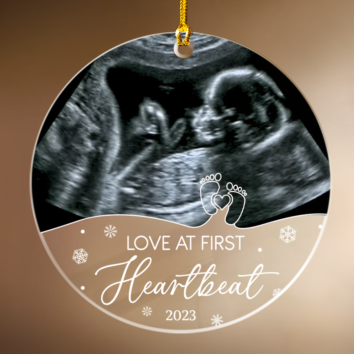 Personalized Bumps First Christmas Acrylic Ornaments Sonogram Ultrasou ...