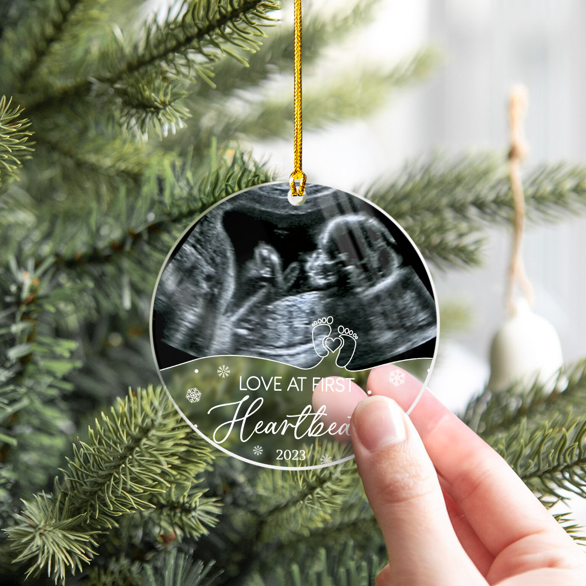 Personalized Bumps First Christmas Acrylic Ornaments Sonogram Ultrasound Picture Photo Pregnancy Announcement Ornament Keepsake Gifts for New Grandparents Expecting Parents
