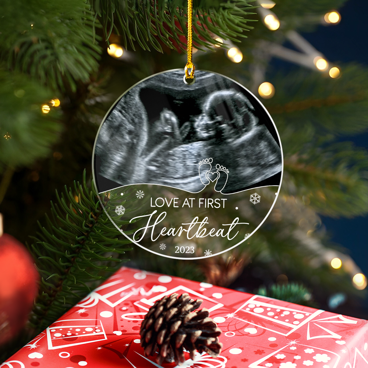 Personalized Bumps First Christmas Acrylic Ornaments Sonogram Ultrasound Picture Photo Pregnancy Announcement Ornament Keepsake Gifts for New Grandparents Expecting Parents