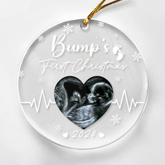 Personalized Bumps First Christmas Ornaments Sonogram Ultrasound Pregnancy Announcement Acrylic Ornament Gift