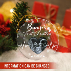 Personalized Bumps First Christmas Ornaments Sonogram Ultrasound Pregnancy Announcement Acrylic Ornament Gift