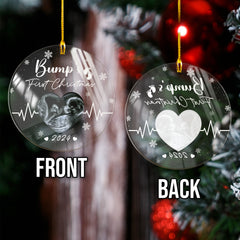 Personalized Bumps First Christmas Ornaments Sonogram Ultrasound Pregnancy Announcement Acrylic Ornament Gift