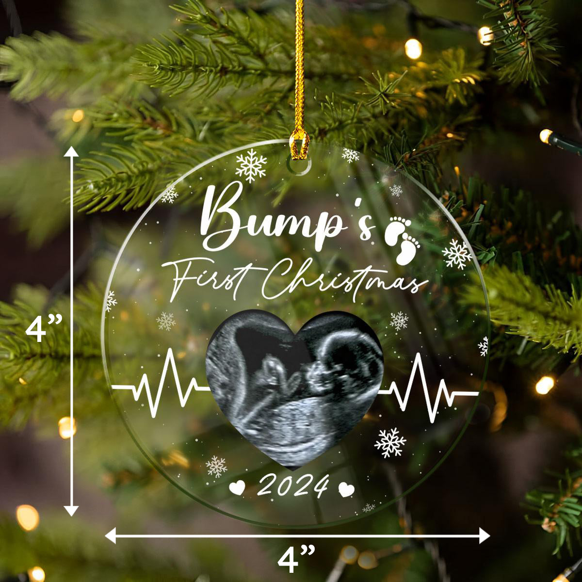 Personalized Bumps First Christmas Ornaments Sonogram Ultrasound Pregnancy Announcement Acrylic Ornament Gift
