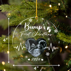 Personalized Bumps First Christmas Ornaments Sonogram Ultrasound Pregnancy Announcement Acrylic Ornament Gift