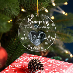 Personalized Bumps First Christmas Ornaments Sonogram Ultrasound Pregnancy Announcement Acrylic Ornament Gift