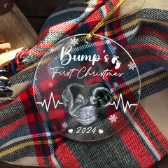 Personalized Bumps First Christmas Ornaments Sonogram Ultrasound Pregnancy Announcement Acrylic Ornament Gift