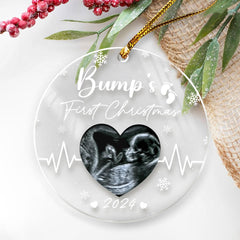 Personalized Bumps First Christmas Ornaments Sonogram Ultrasound Pregnancy Announcement Acrylic Ornament Gift